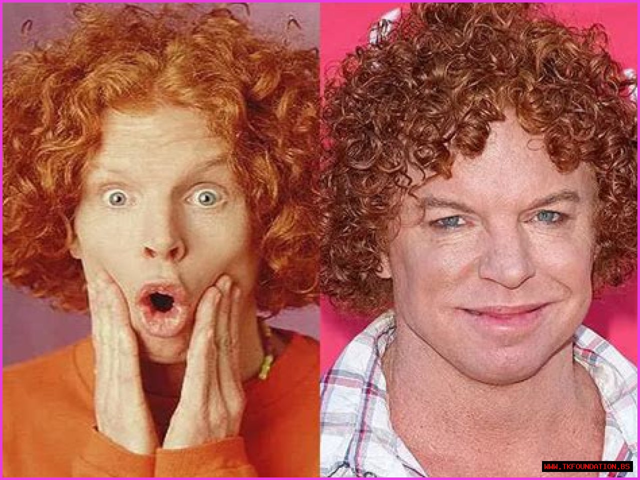 Carrot Top Denies Plastic Surgery Claims, Says The Before And After Changes Are Due To Workouts