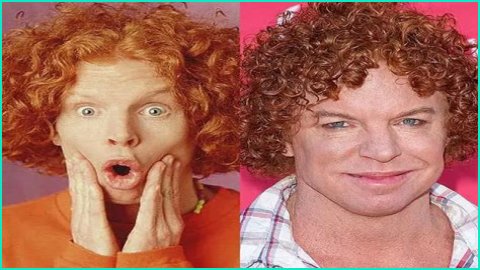 Carrot Top Denies Plastic Surgery Claims, Says The Before And After Changes Are Due To Workouts