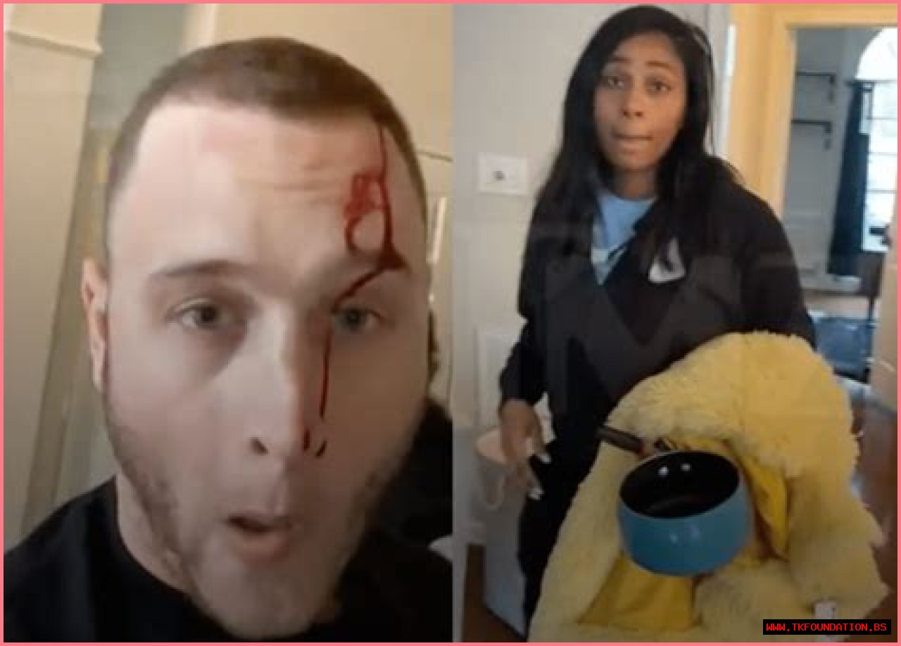 Chet Hanks: My Girlfriend Stabbed Me In the Head!